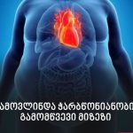 ვაქცინა ხელმისაწვდომია ყველა აფთიაქში…“ | შენი სილამაზე