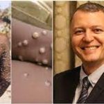 „სიგარეტის მოწევა უფრო საშიშია და უფრო ცუდი შედეგი მოაქვს, ვიდრე მაიმუნის ყვავილს…“ | შენი სილამაზე