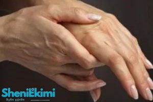ეგზემით დაავადებული ქალის ხელი – წითელი, გაღიზიანებული კანი