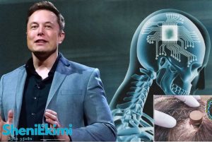 ილონ მასკის Neuralink-ის ნეიროჩიპი ტვინის ინტერფეისისთვის
