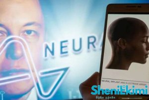 ტვინის ჩიპი Neuralink ტექნოლოგია ნეირო ინტერფეისი