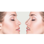როგორ უნდა მოვიქცეთ თმის ცვენის დროს | შენი სილამაზე