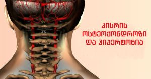 ქალი ასრულებს კისრის ვარჯიშებს ოსტეოქონდროზის საწინააღმდეგოდ