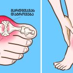 მთელი ზამთარი ვაგროვებდი ყავის ნალექს ამ ექსპერიმენტისთვის. | შენი სილამაზე