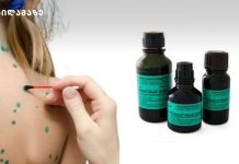 აი, რატომ აღარ გამოიყენება ბრილიანტის მწვანე ჭრილობების შესახორცებლად