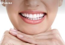 კბილების ჯანმრთელობა – ყველაფერი, რაც უნდა იცოდეთ ჯანმრთელი ღიმილისთვის