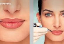 ქალმა გადაწყვიტა პოპულარული პროცედურა გაეკეთებინა – ტუჩის ტატუაჟი, პროცესი კი ვიდეოზე ჩაწერა. აი შედეგი