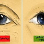 6 მთავარი მიზეზი, რაც წელის ტკივილს იწვევს და მისი იგნორი არ შეიძლება | შენი სილამაზე
