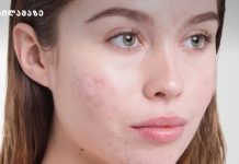 ჩირქოვანი გამონაყარის მკურნალობის 8 შინაური საშუალების რეცეპტი