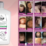 თმის ცვენა გაწუხებს? სცადე DR. C. TUNA ნივრის შამპუნი და დაივიწყე ეს პრობლემა!