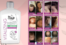 თმის ცვენა გაწუხებს? სცადე DR. C. TUNA ნივრის შამპუნი და დაივიწყე ეს პრობლემა!