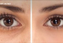 როგორ მოვუაროთ ჩაშავებულ თვალის უპეებს – საუკეთესო მეთოდები და რჩევები