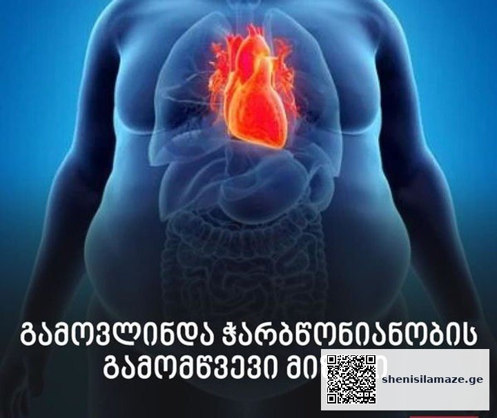 ჭარბწონიანობის მიზეზი გამოავლინეს – მასშტაბური კვლევის მიგნებები | შენი სილამაზე