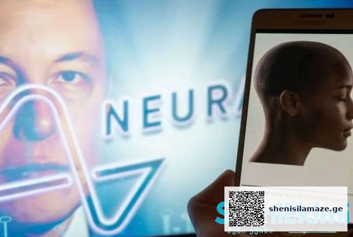 Neuralink-მა ადამიანის ტვინში ჩიპი პირველად ჩანერგა | შენი სილამაზე