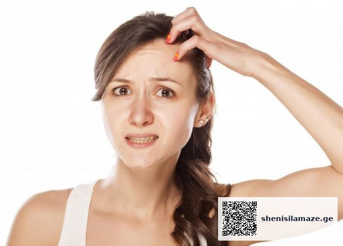როგორ მოვიშოროთ ქერტლი?